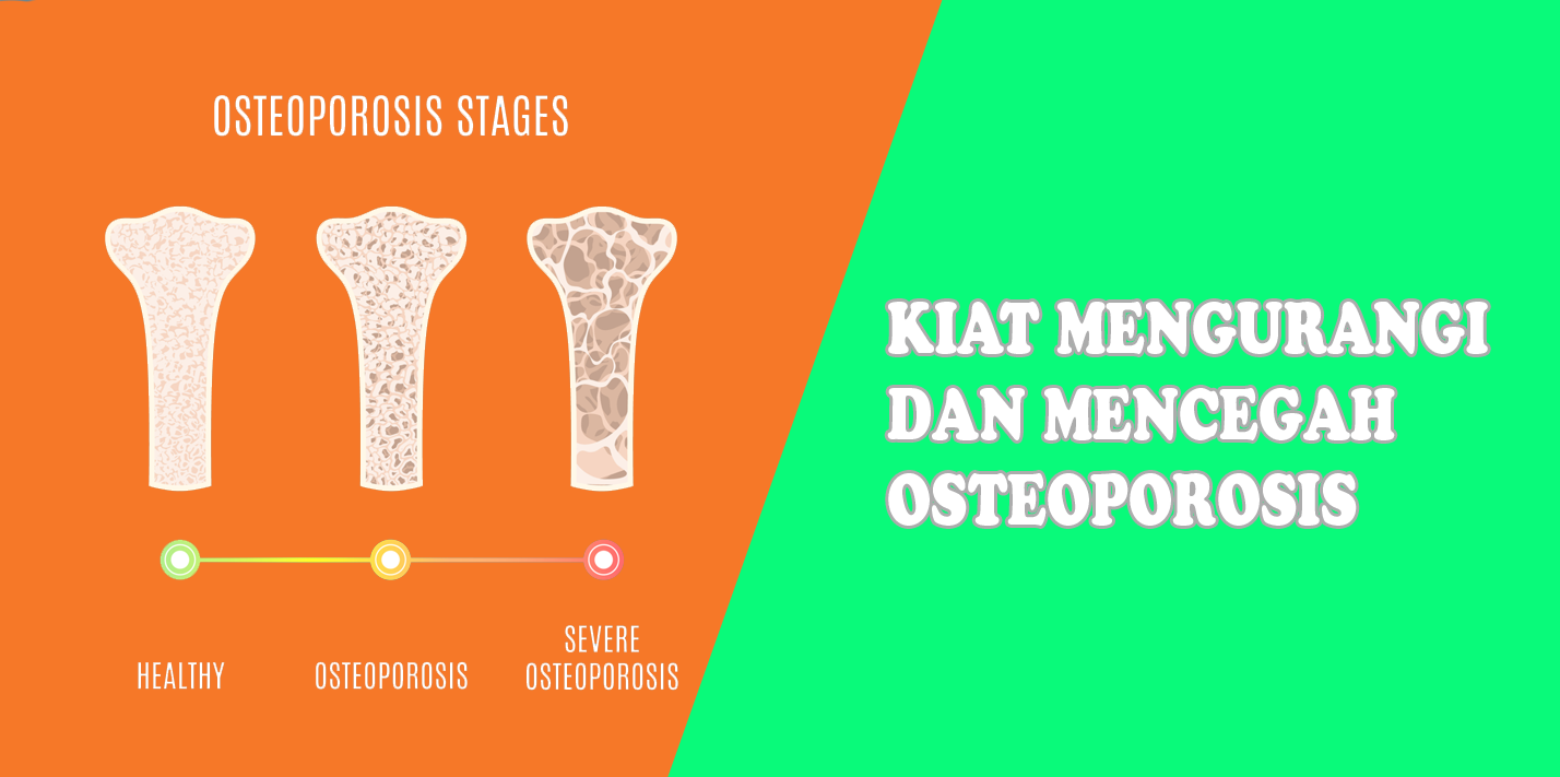 Kiat Mengurangi Dan Mencegah Osteoporosis Kiat Mengurangi Dan Mencegah Osteoporosis