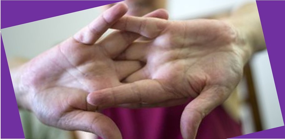 Fakta Krek, Resiko Membunyikan Sendi Fakta Krek, Resiko Membunyikan Sendi