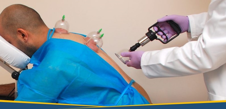 Bekam dan Imunitas Tubuh